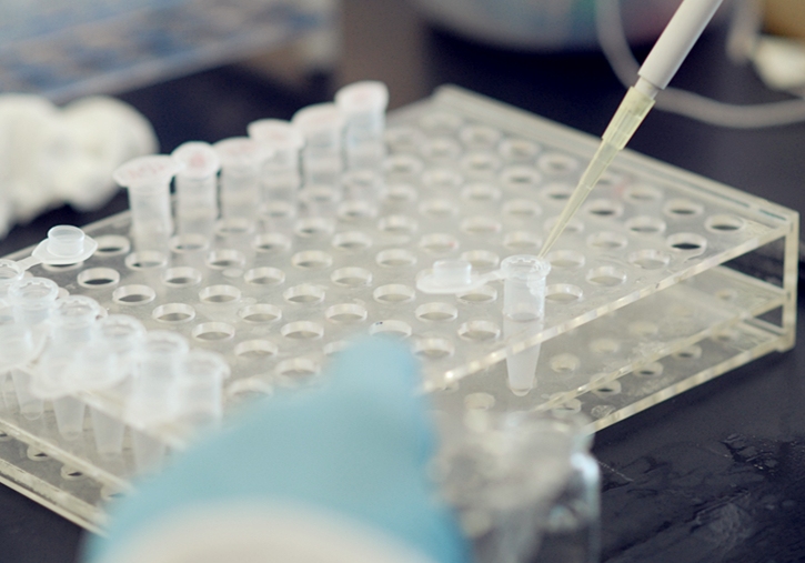 Centrifuge tubes takes physical strain and chemical cleanness