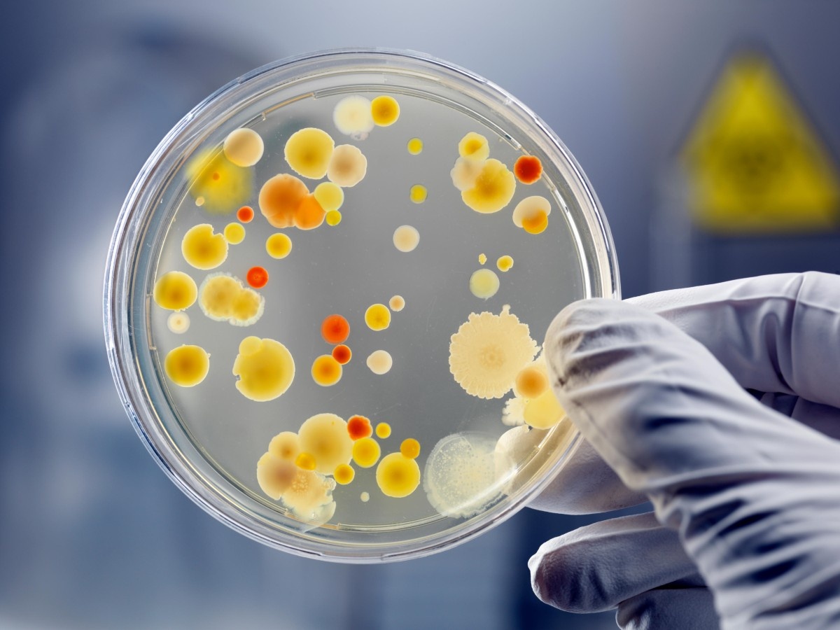 Hidden plasticware factors affecting cell culture contamination and reproducibility